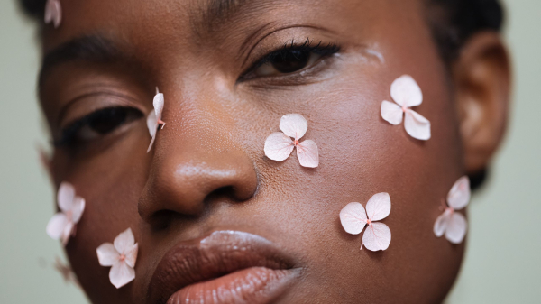 I Thought It Was Acne. Turns Out, It Was Lupus.